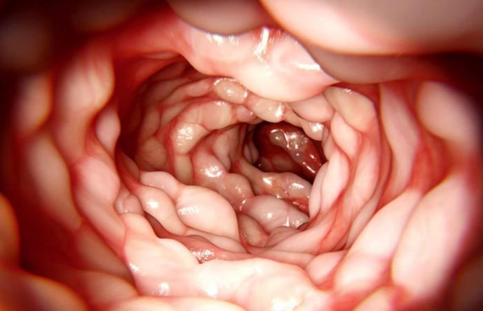 inflamacion grafeno.jpg